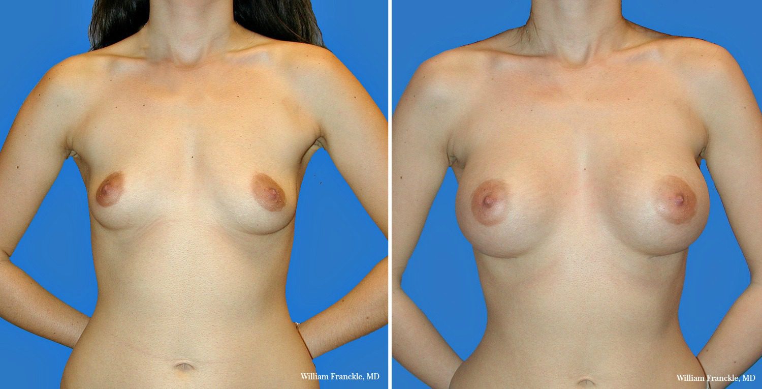 patient7_front